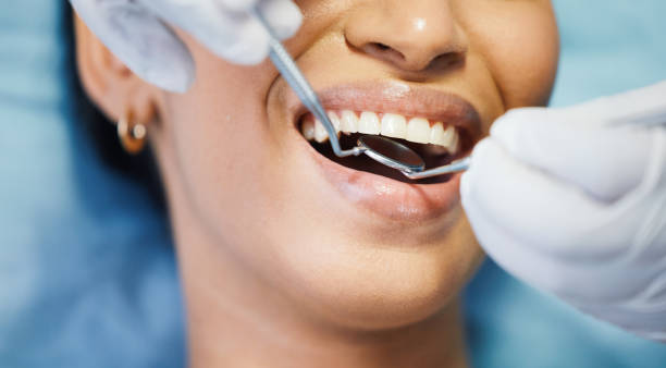 Emergency Dental Filling Replacement in TN