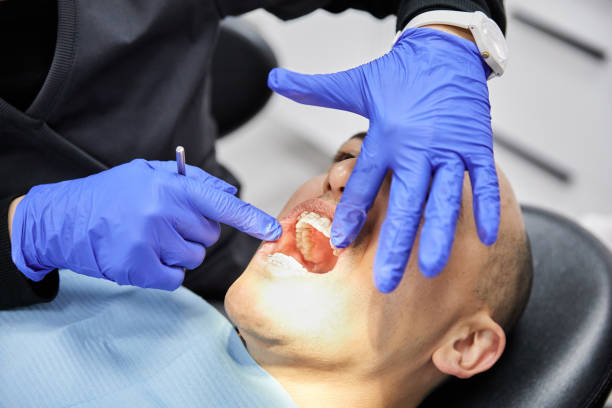 Best Dentist for Tooth Abscess  in Rossville, TN